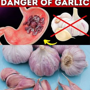 Take Garlic, But Avoid This Common Mistake! | 95% of People Are Unaware ...